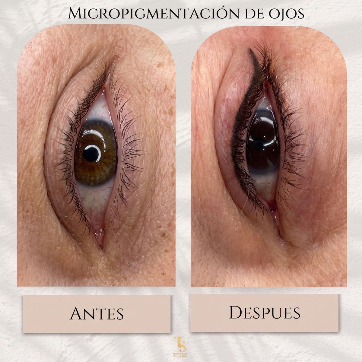 Línea de Ojos antes y después — TS Microblading